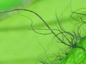 How To Control Staghorn Algae In Your Aquarium