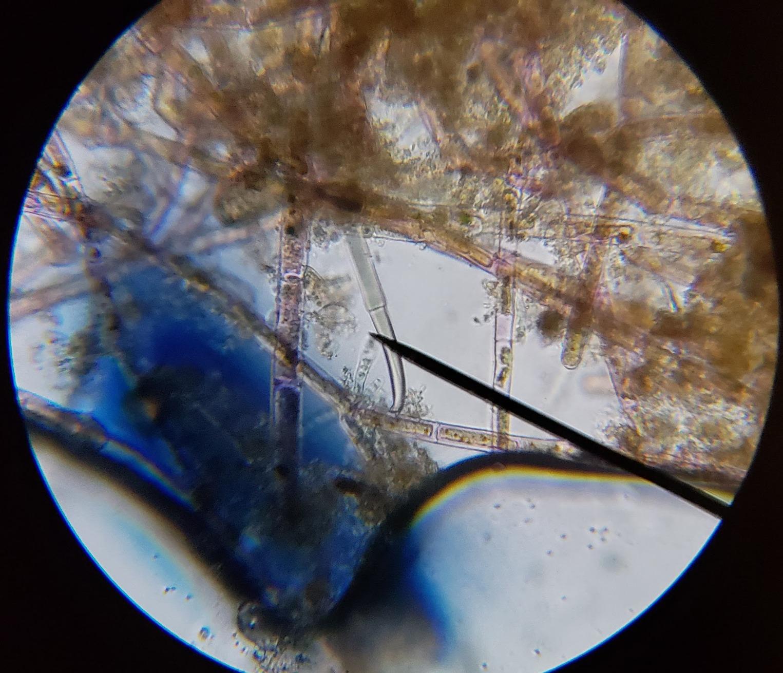 AmScope M150C 1000X All-Metal Optical Glass Lenses Cordless LED | 40X-1000X Magnification Range Compound Biological Microscope customer photo 1