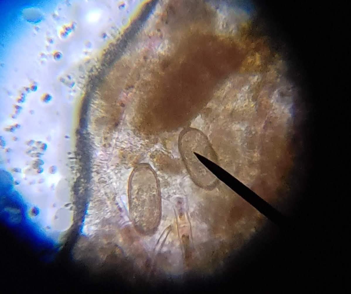 AmScope M150C 1000X All-Metal Optical Glass Lenses Cordless LED | 40X-1000X Magnification Range Compound Biological Microscope customer photo 2