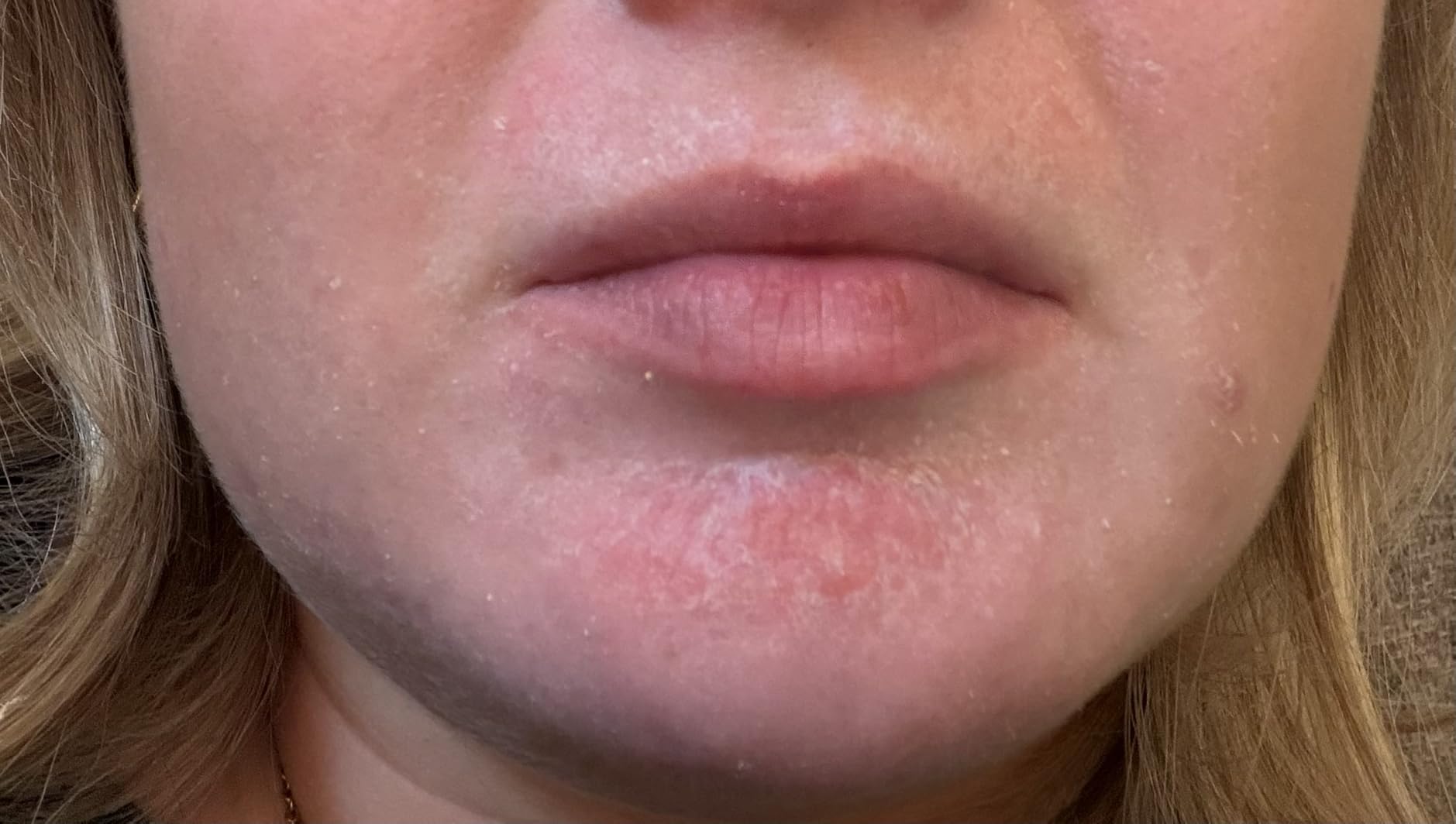 La Roche-Posay Cicaplast Balm B5, Barrier Repair Cream for Dry Skin customer photo 1