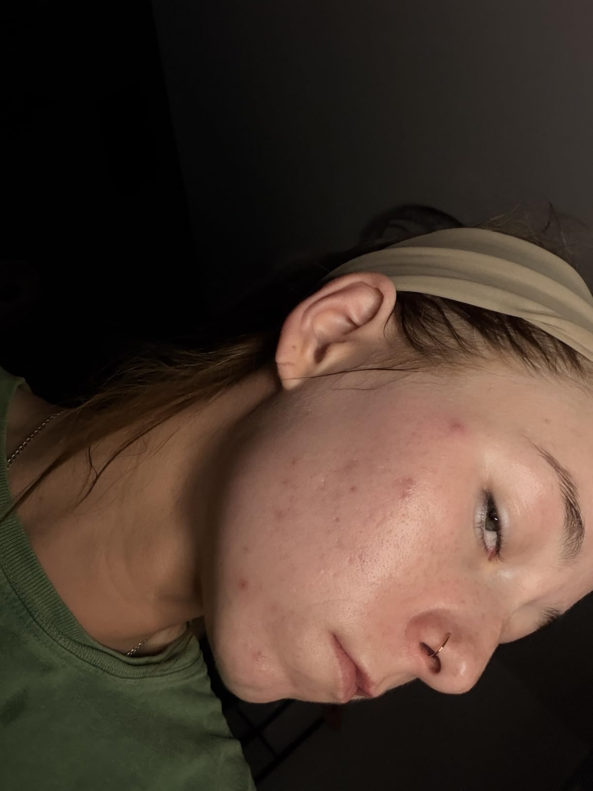 Paula's Choice SKIN PERFECTING 2% BHA Liquid Leave-On Exfoliant customer photo 1