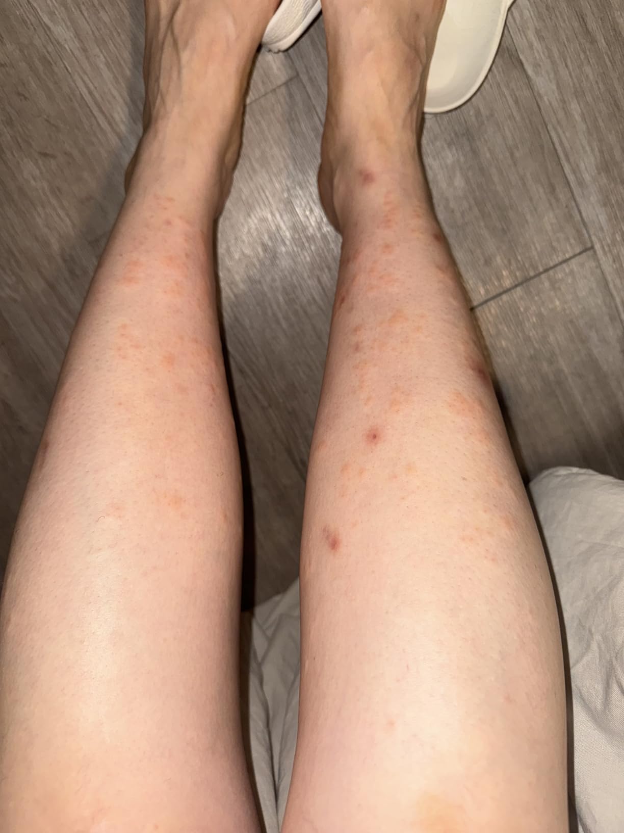 Braun IPL, Silk·Expert Pro 5, IPL Hair Removal for Women and Men, Permanent Laser Hair Reduction At-Home, 4 Heads, IPL5347 customer photo 1